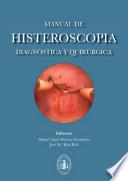 Manual de histeroscopia diagnóstica y quirúrgica